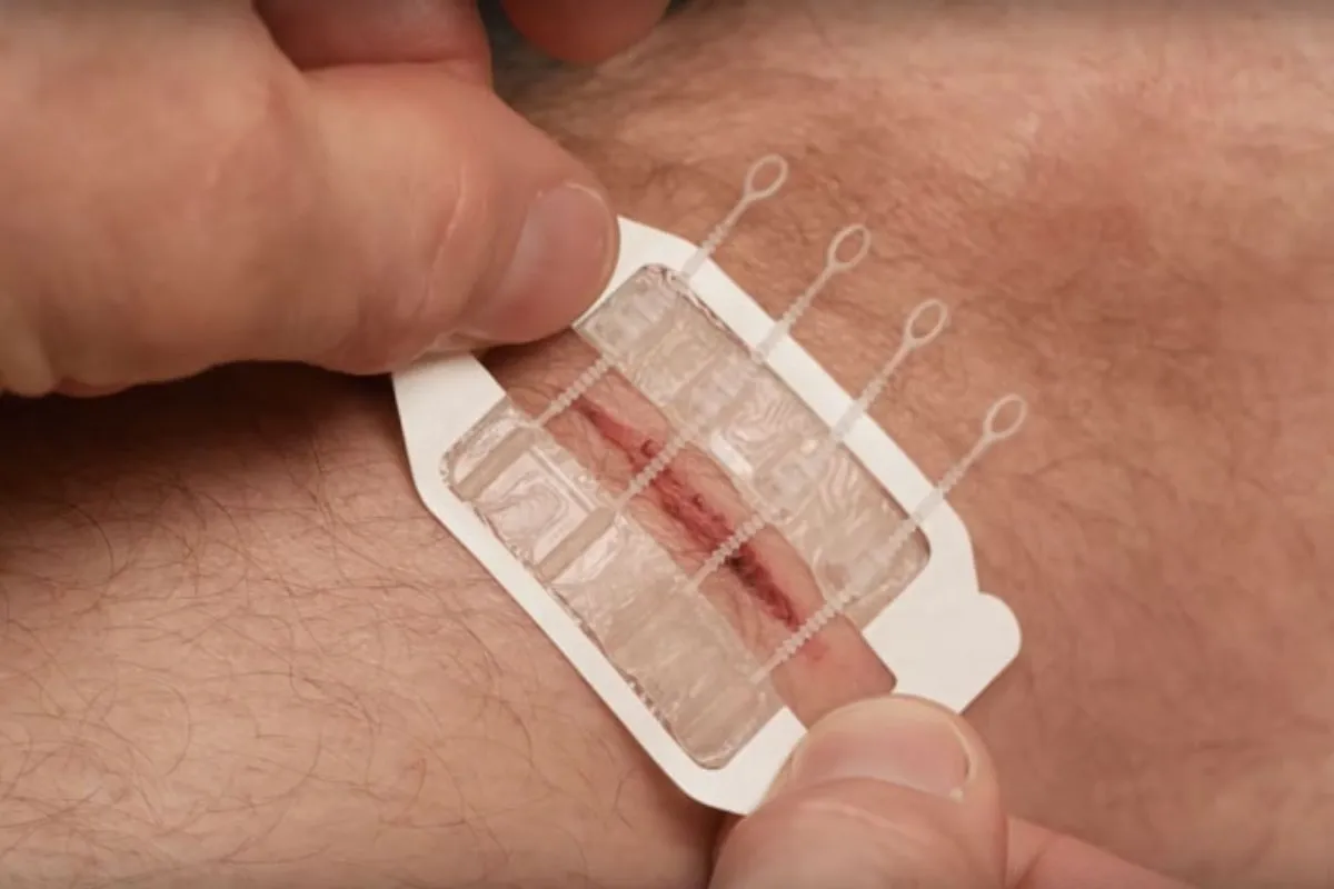 Refill Kits